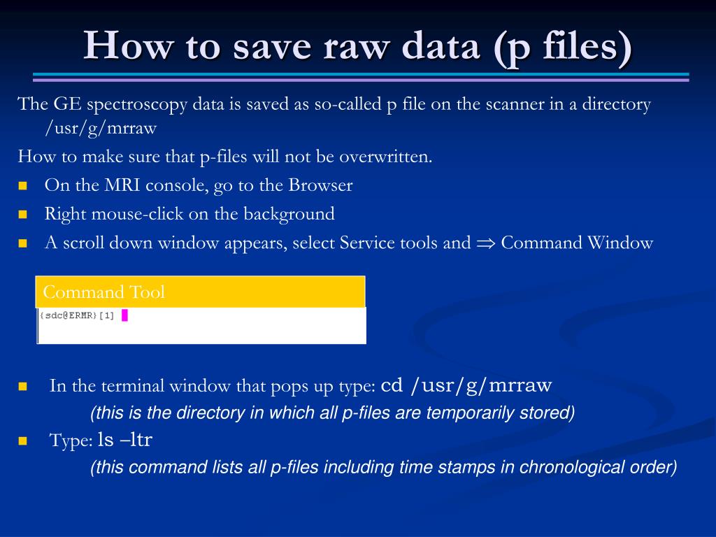 PPT ACRIN6684 MRS data acquisition and Raw Data Handling