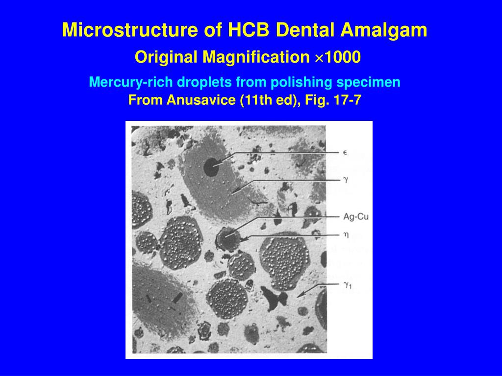 PPT Dent 633 Dental Amalgam PowerPoint Presentation, free download