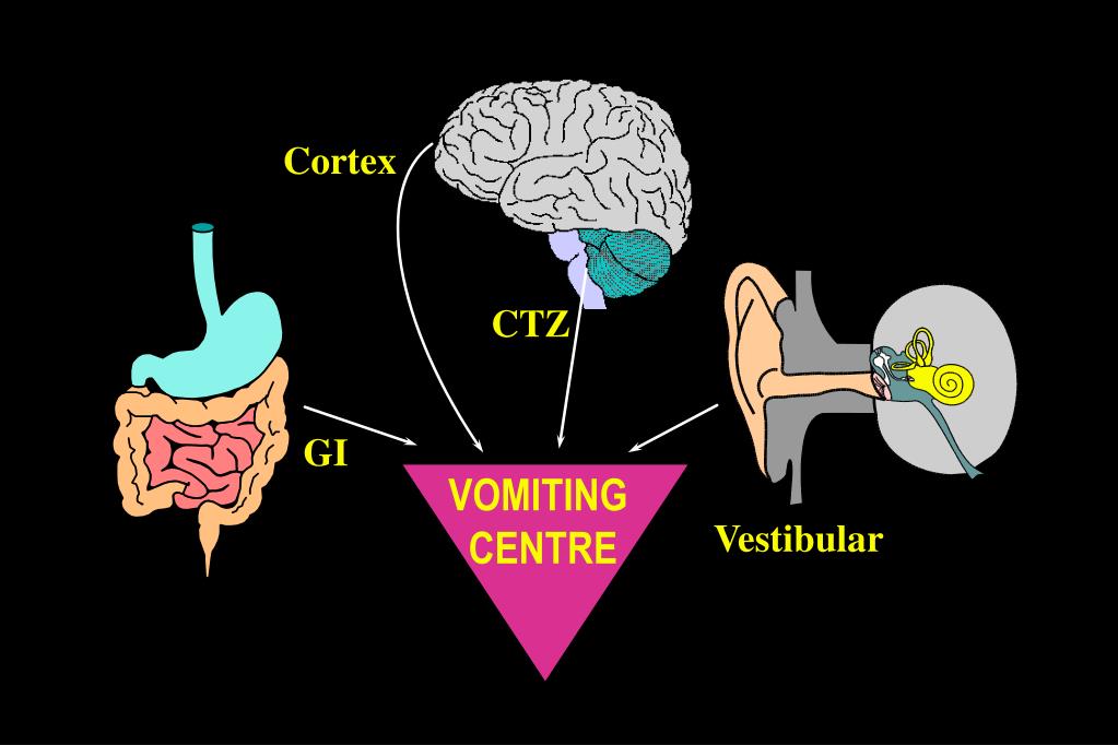 PPT MANAGEMENT OF NAUSEA AND VOMITING IN PALLIATIVE CARE PowerPoint