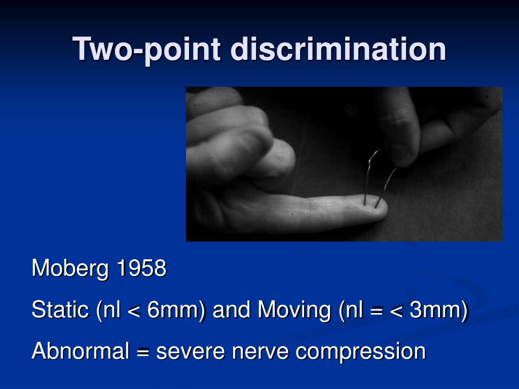 PPT Carpal Tunnel Syndrome PowerPoint Presentation, free download