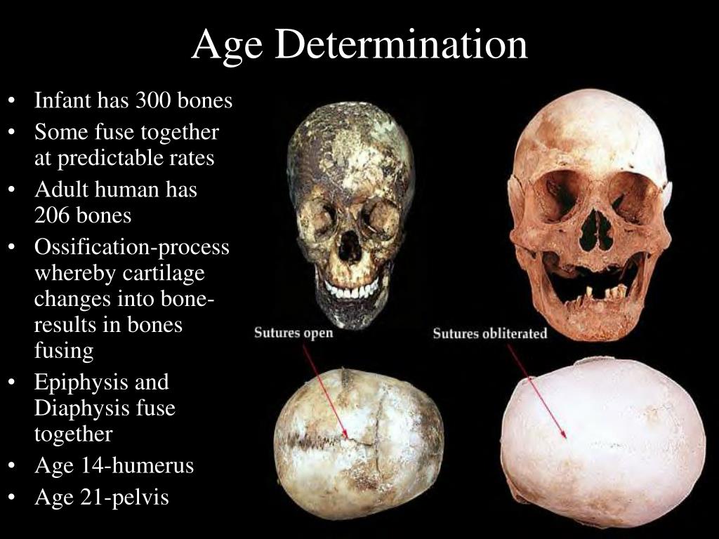 PPT Identification of Human Remains PowerPoint Presentation, free