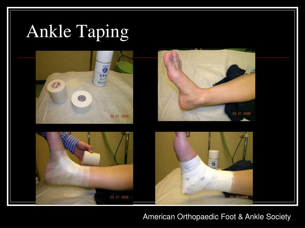Ankle Taping Diagram