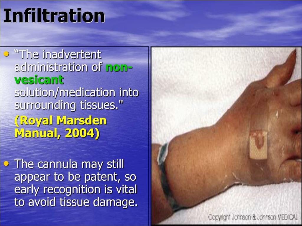 PPT CANNULATION & VENESECTION PowerPoint Presentation, free download