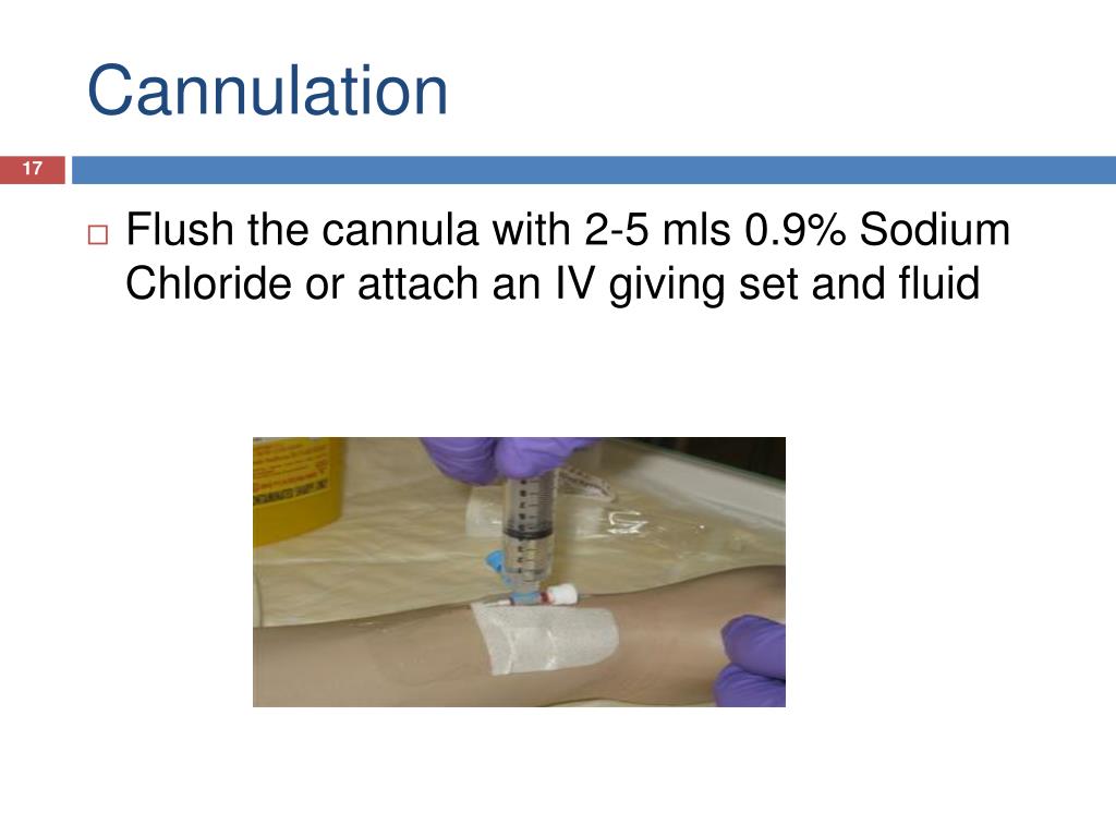 PPT INTRAVENOUS CANNULATION PowerPoint Presentation, free download