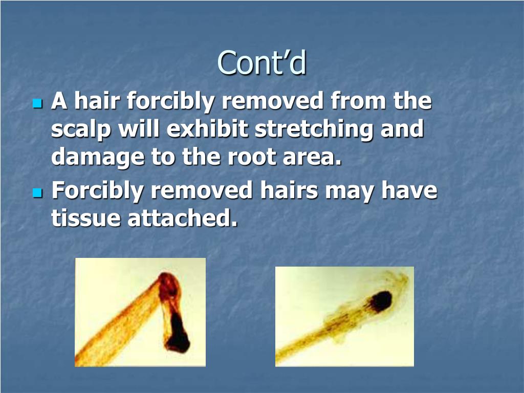 PPT Forensic Hair Analysis PowerPoint Presentation, free download