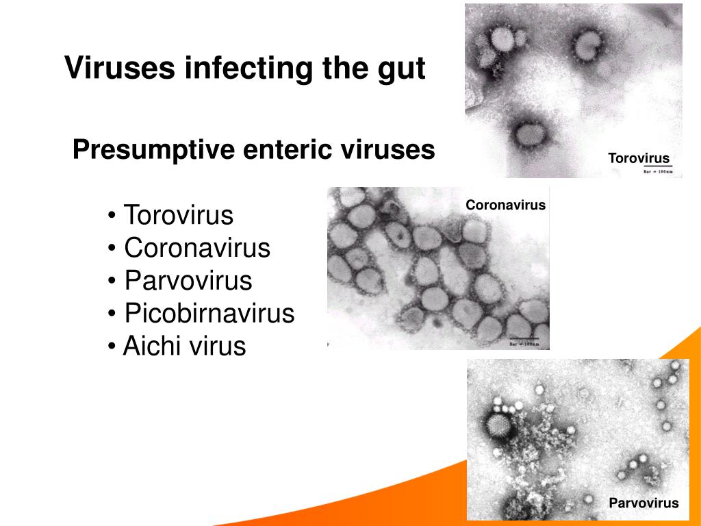 PPT Enteric viruses PowerPoint Presentation, free download ID174062