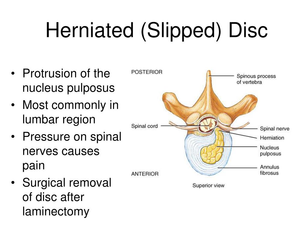 PPT Lab05 Vertebrae Ribs and rib articulation Sternum Skull Review PowerPoint Presentation