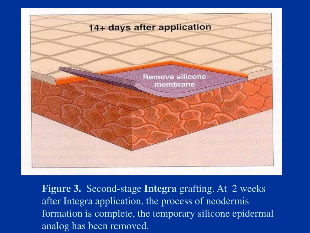 PPT Biochemical Engineering CEN 551 PowerPoint Presentation, free
