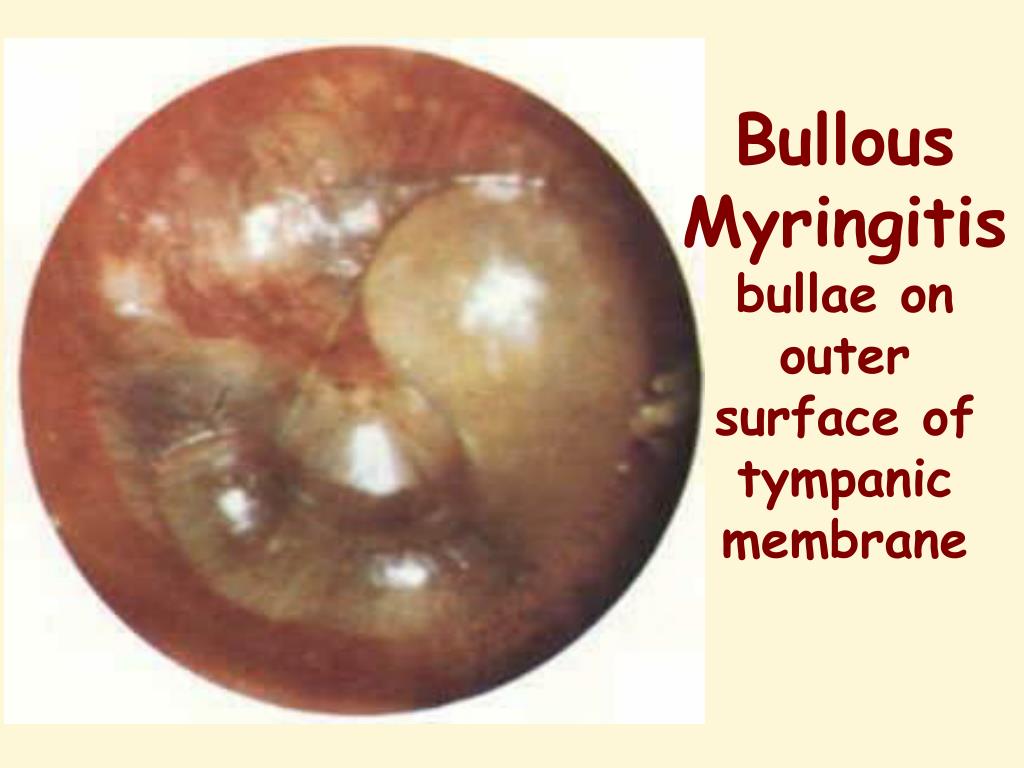 PPT OTOSCOPY by Professor Dr Hassan Wahba Ear, Nose & Throat