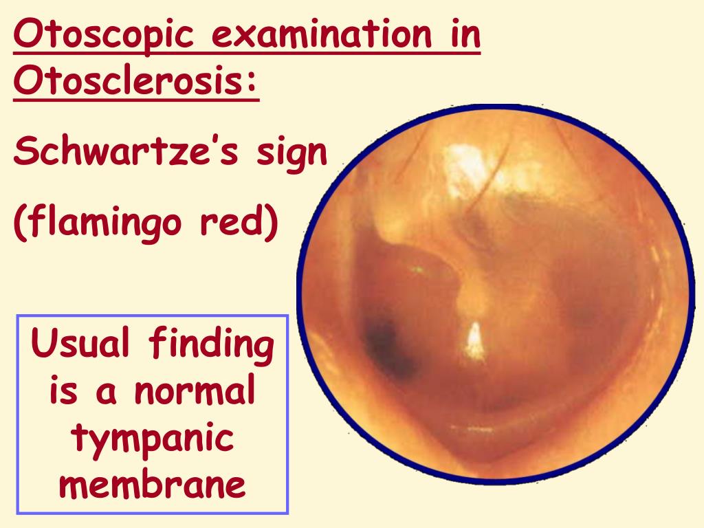 PPT OTOSCOPY by Professor Dr Hassan Wahba Ear, Nose & Throat