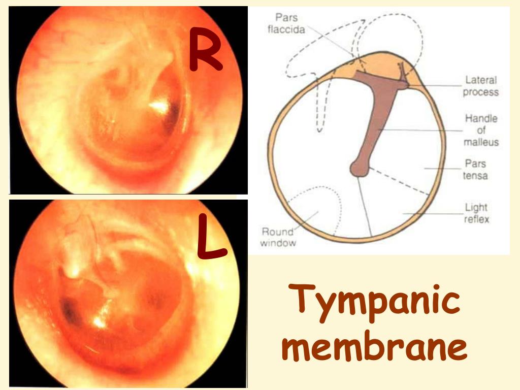 PPT OTOSCOPY by Professor Dr Hassan Wahba Ear, Nose & Throat