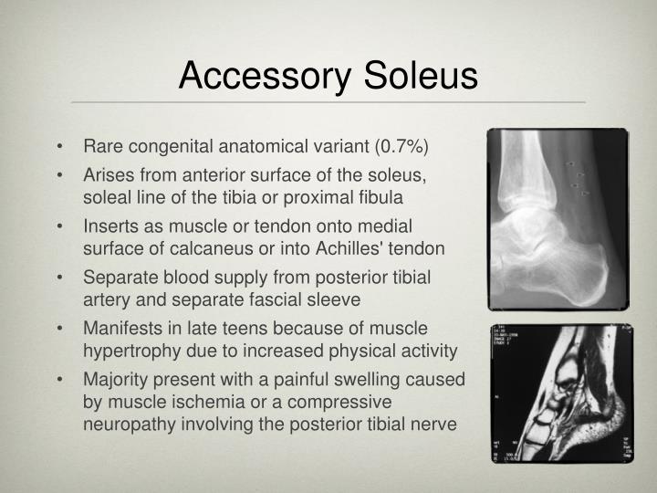 PPT Anatomy and Pathology of the Achilles Tendon Tracy MacNair