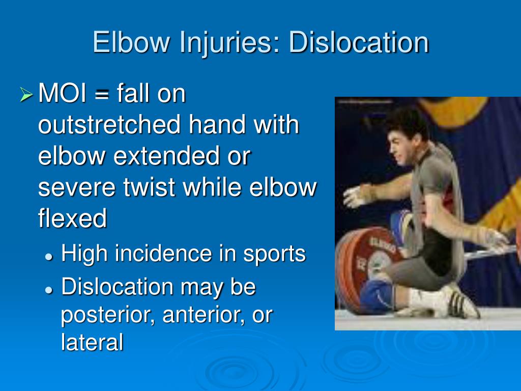 PPT The Elbow PowerPoint Presentation, free download ID195044