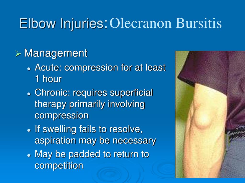 PPT The Elbow PowerPoint Presentation, free download ID195044