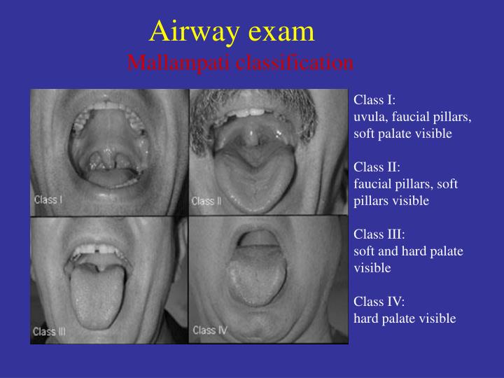 PPT Clinical Anesthesia PowerPoint Presentation ID195210