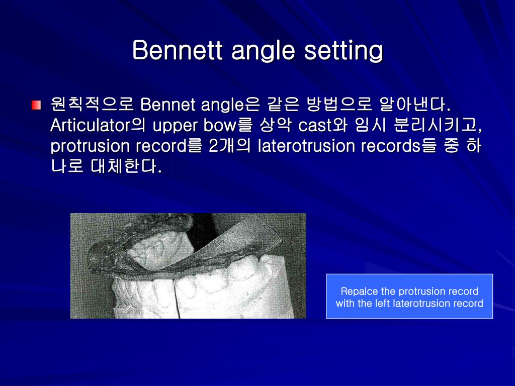 PPT 4.9 Articulator setting PowerPoint Presentation, free download