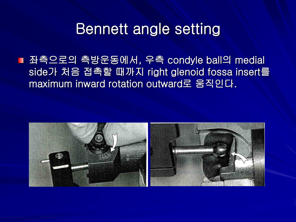 PPT 4.9 Articulator setting PowerPoint Presentation ID195959