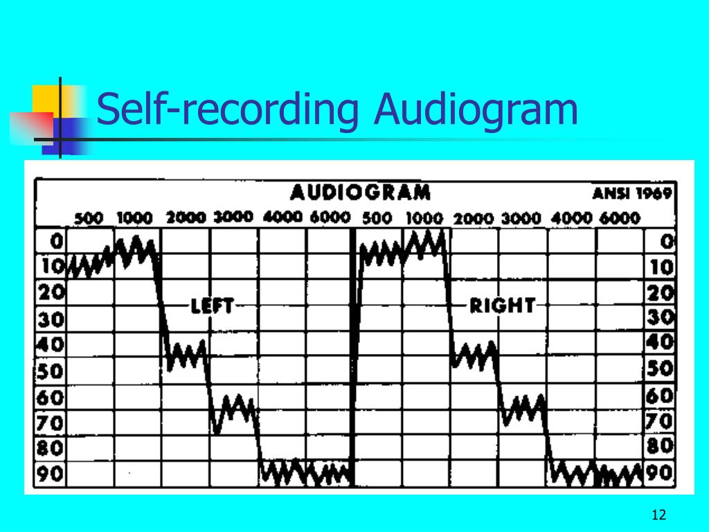 PPT The Audiogram PowerPoint Presentation ID199868