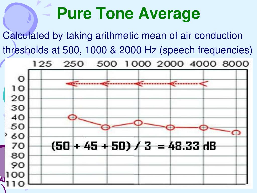PPT Audiometry PowerPoint Presentation, free download ID199892