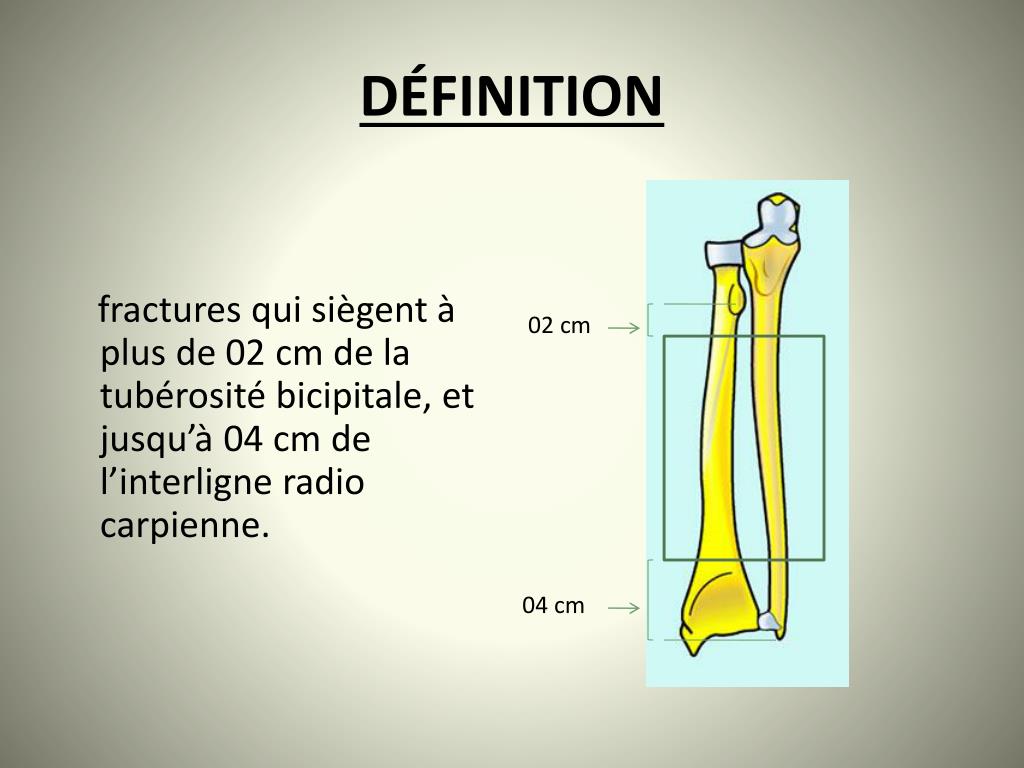 PPT Fracture des 2os de l’avant bras PowerPoint Presentation, free