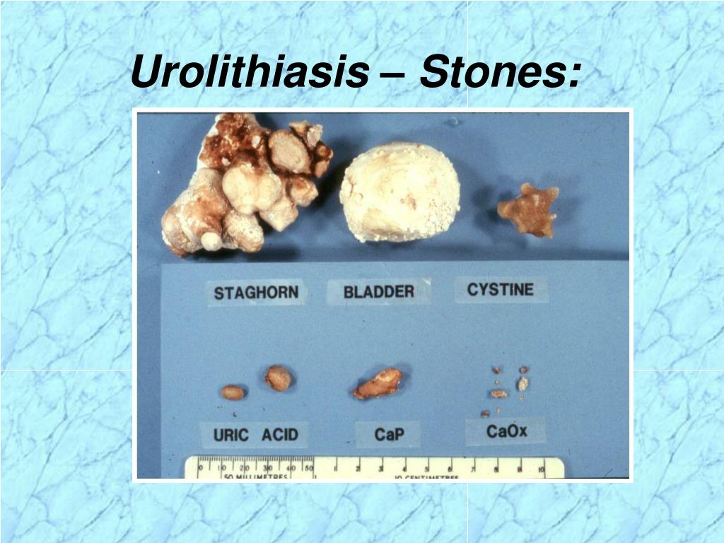 PPT AnatomyKidney PowerPoint Presentation ID201308