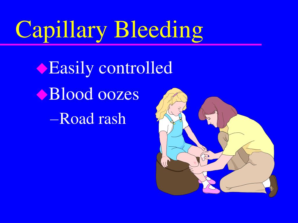 PPT Bleeding And Wounds PowerPoint Presentation, free download ID