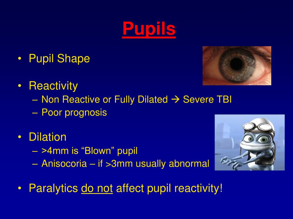 PPT Traumatic Brain Injury (TBI) PowerPoint Presentation ID205380