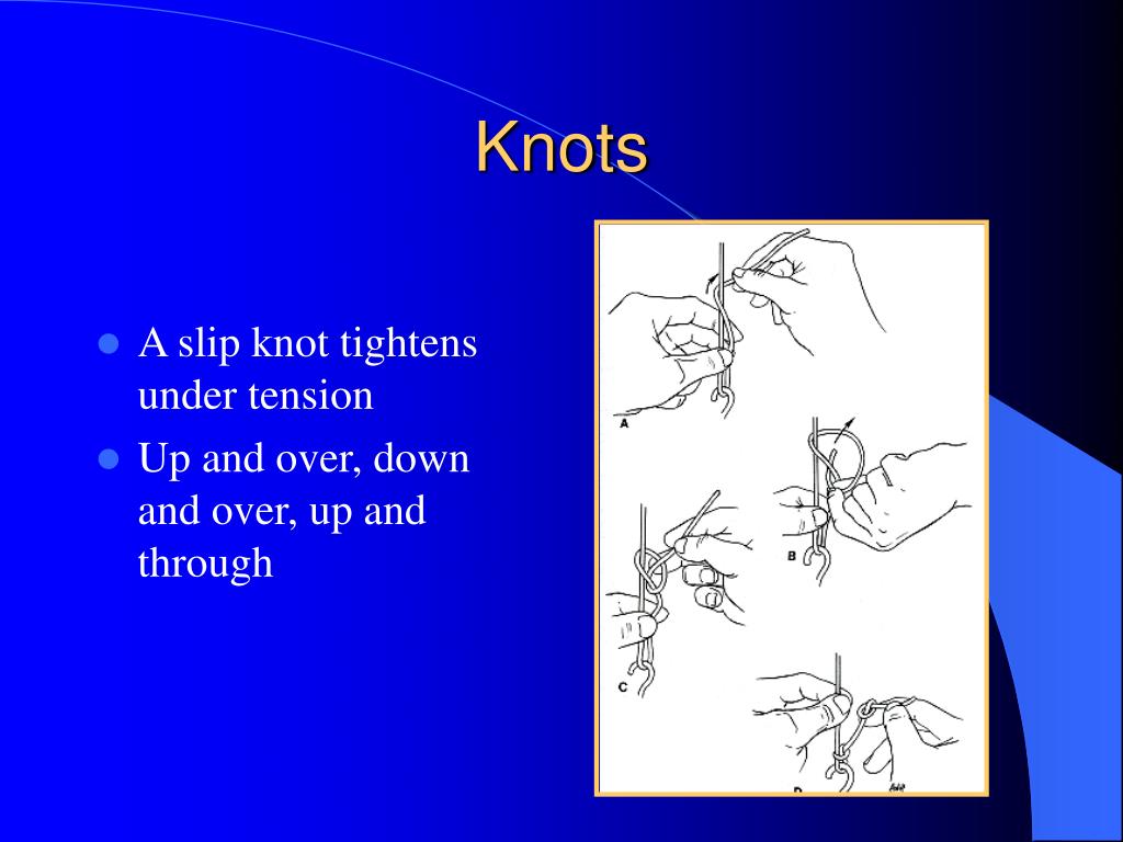 PPT Orthopaedic Traction PowerPoint Presentation, free download ID