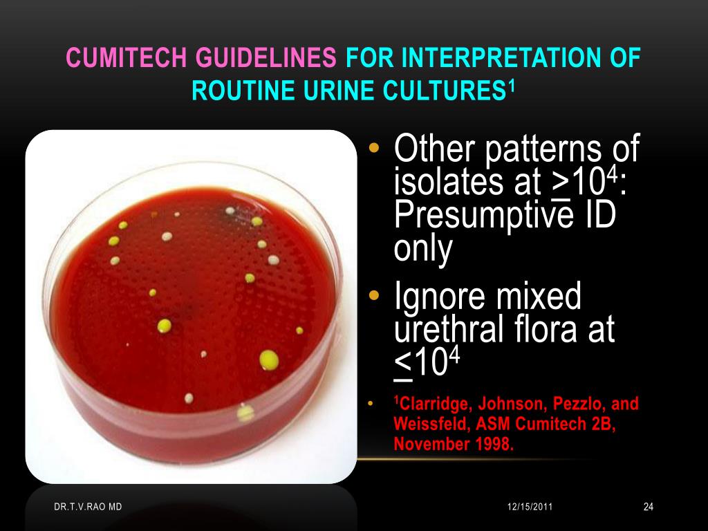PPT Interpretation of Urine Cultures PowerPoint Presentation ID212996