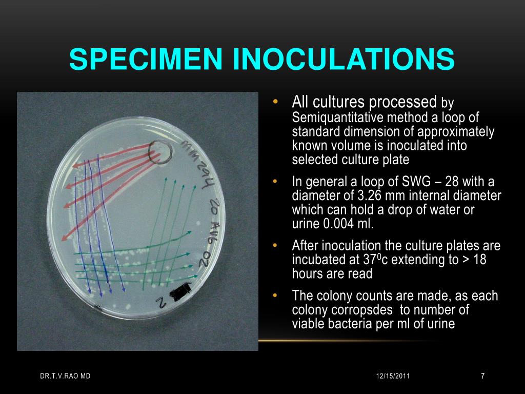 PPT Interpretation of Urine Cultures PowerPoint