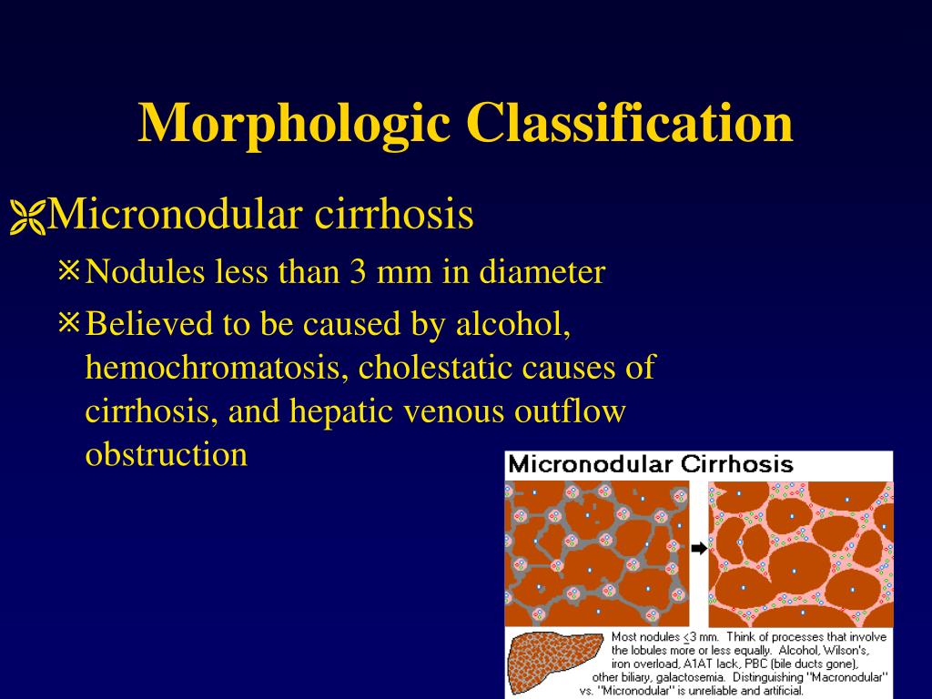 PPT Liver Cirrhosis PowerPoint Presentation, free download ID217163