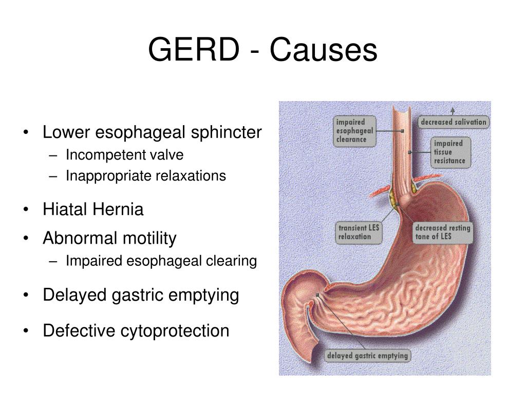 PPT Swallowing Difficulty & Pain PowerPoint Presentation, free