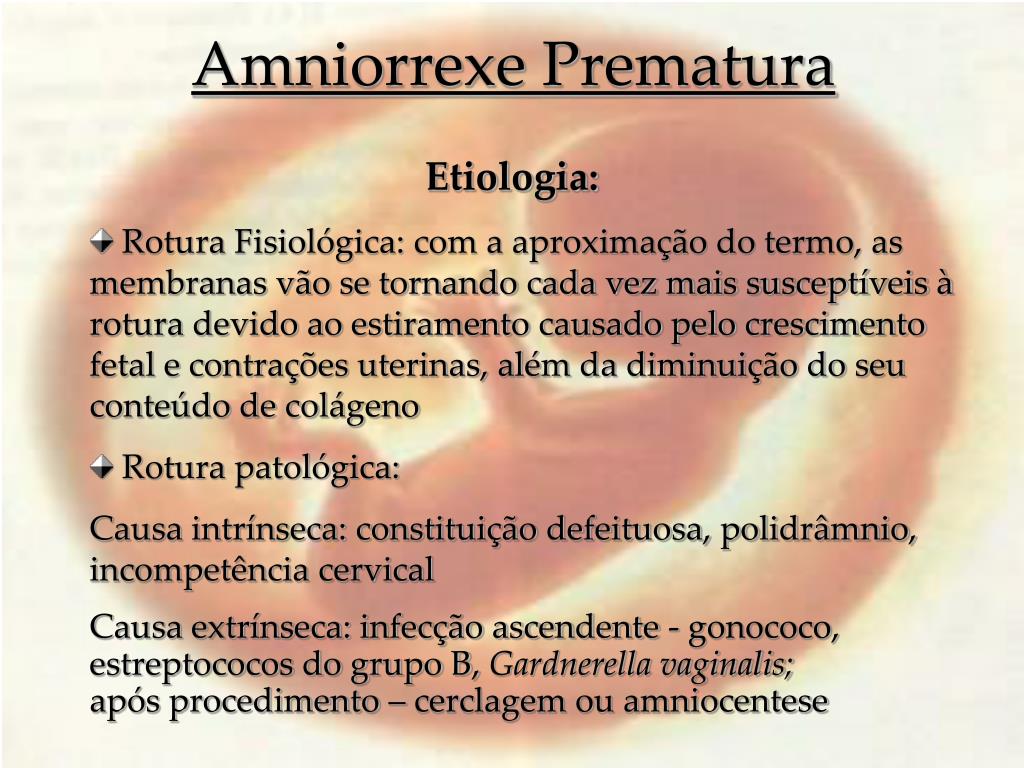 PPT Amniorrexe Prematura PowerPoint Presentation, free download ID
