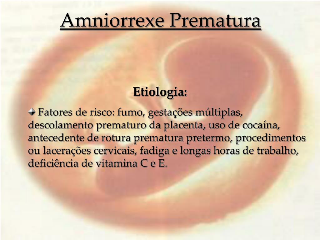 PPT Amniorrexe Prematura PowerPoint Presentation, free download ID