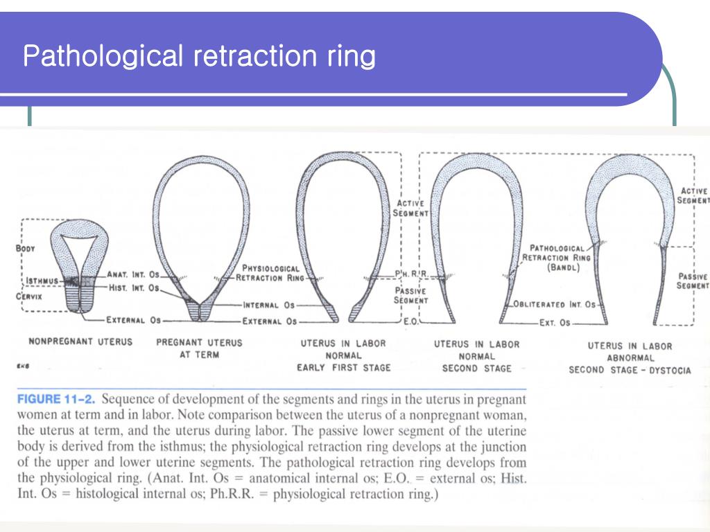 PPT CHPTER 18 DYSTOCIA PowerPoint Presentation, free download ID222738