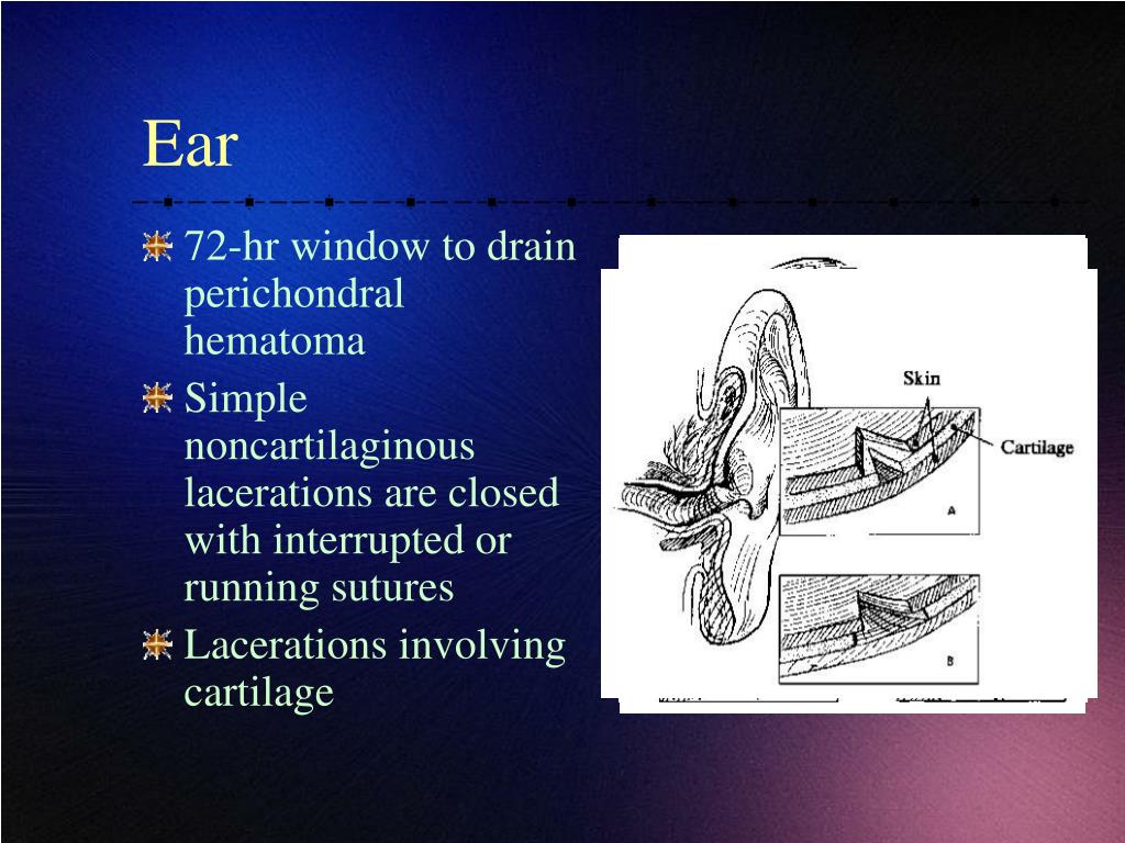 PPT Advanced Suturing Techniques PowerPoint Presentation, free download ID223315