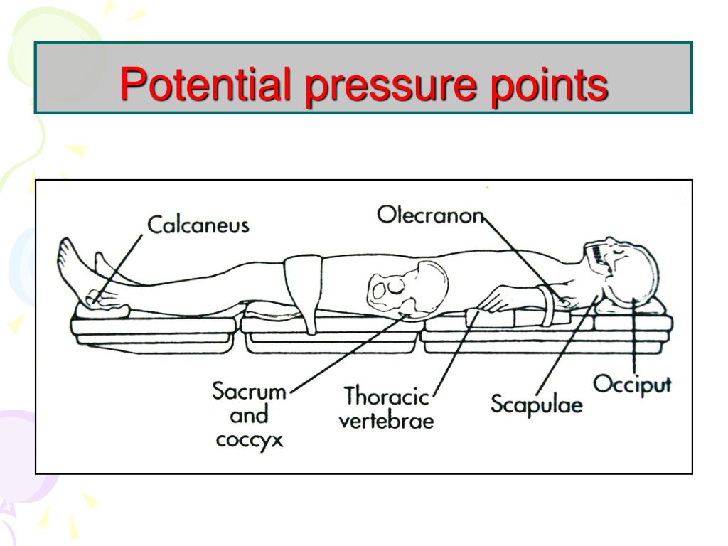 PPT POSITIONING IN OPERATING THEATRE PowerPoint