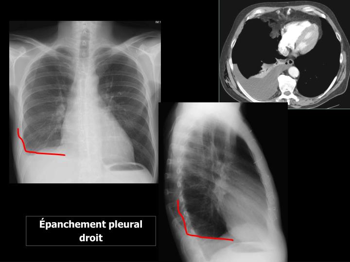 PPT eanatomy PowerPoint Presentation ID227443