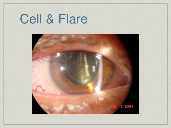 PPT Essentials of Ophthalmology PowerPoint Presentation ID22855