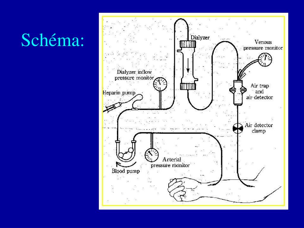 PPT La dialyse pour « les nuls » (1) PowerPoint Presentation, free
