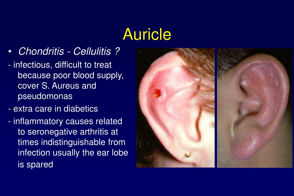 PPT ENT Emergencies PowerPoint Presentation ID242507