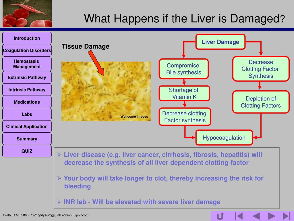 PPT Coagulation Disorders (Coagulopathy) PowerPoint Presentation