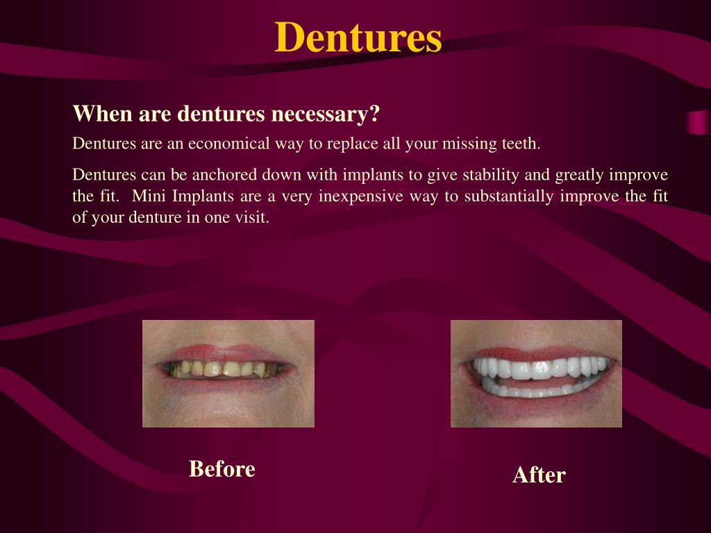 PPT Dental Health Care Associates Experience the Difference… 5000