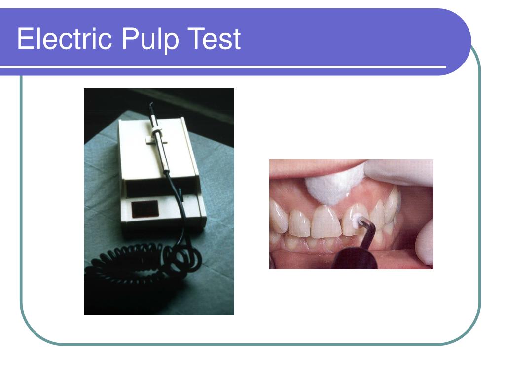 PPT Diagnosis and Treatment Planning PowerPoint Presentation, free