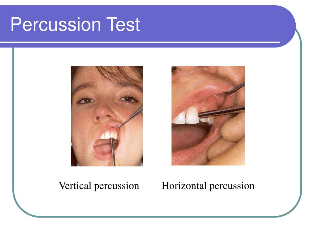 PPT Diagnosis and Treatment Planning PowerPoint Presentation, free
