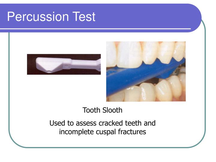 PPT Diagnosis and Treatment Planning PowerPoint Presentation ID249702