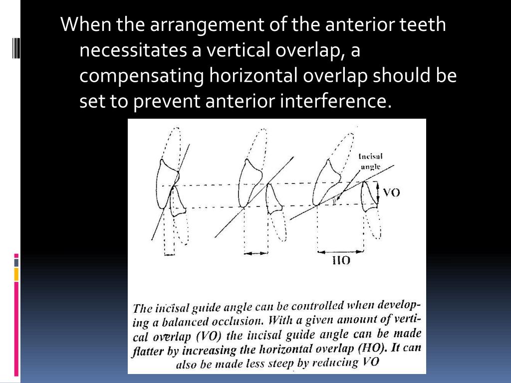 PPT Principles of occlusion in complete denture PowerPoint