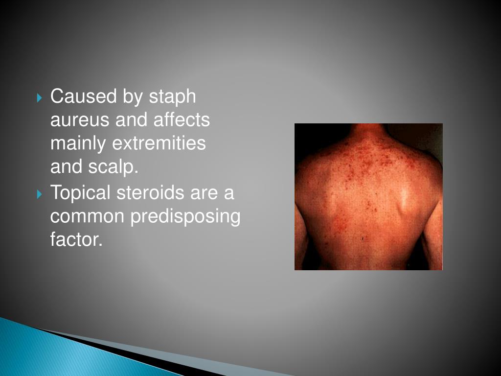 PPT Bacterial Skin Infection PowerPoint Presentation, free download