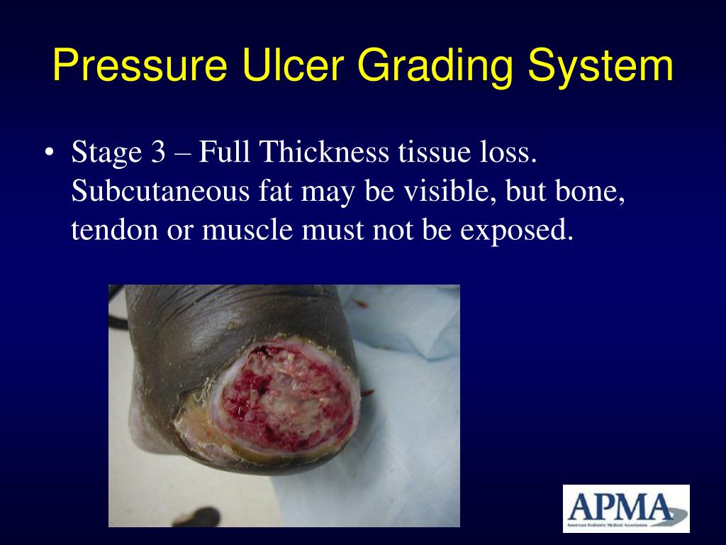 PPT Coding for Wound Care in 2011 Updates and Changes