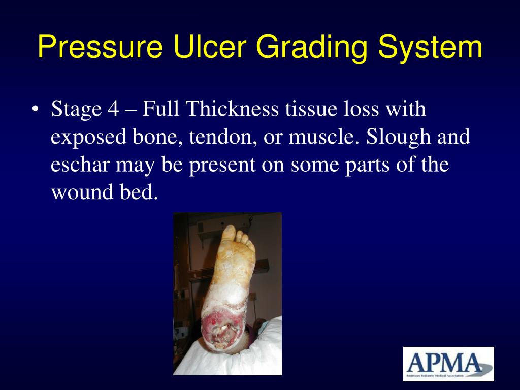 PPT Coding for Wound Care in 2011 Updates and Changes